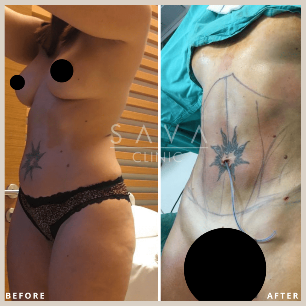 10Plastic-Surgery.png