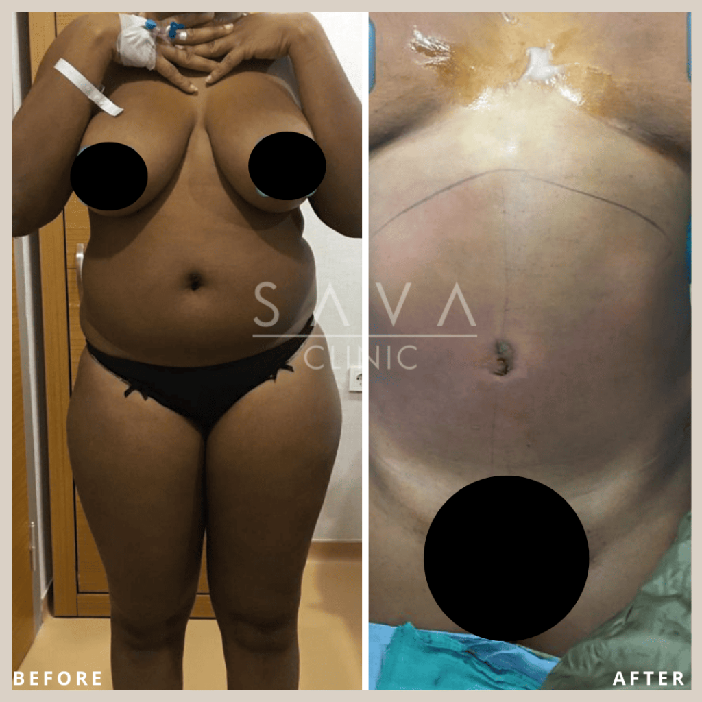 13Plastic-Surgery.png