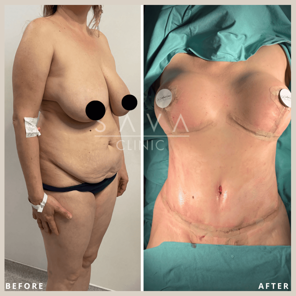 5Plastic-Surgery.png